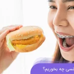 بعد از ارتودنسی چه بخوریم