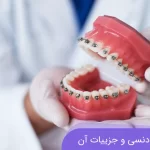 مشاهده ارتودنسی و جزییات آن