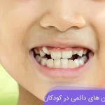 رویش دندان های دائمی در کودکان